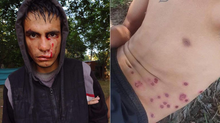 Once jovenes fueron heridos con balas de gomas en Escobar.