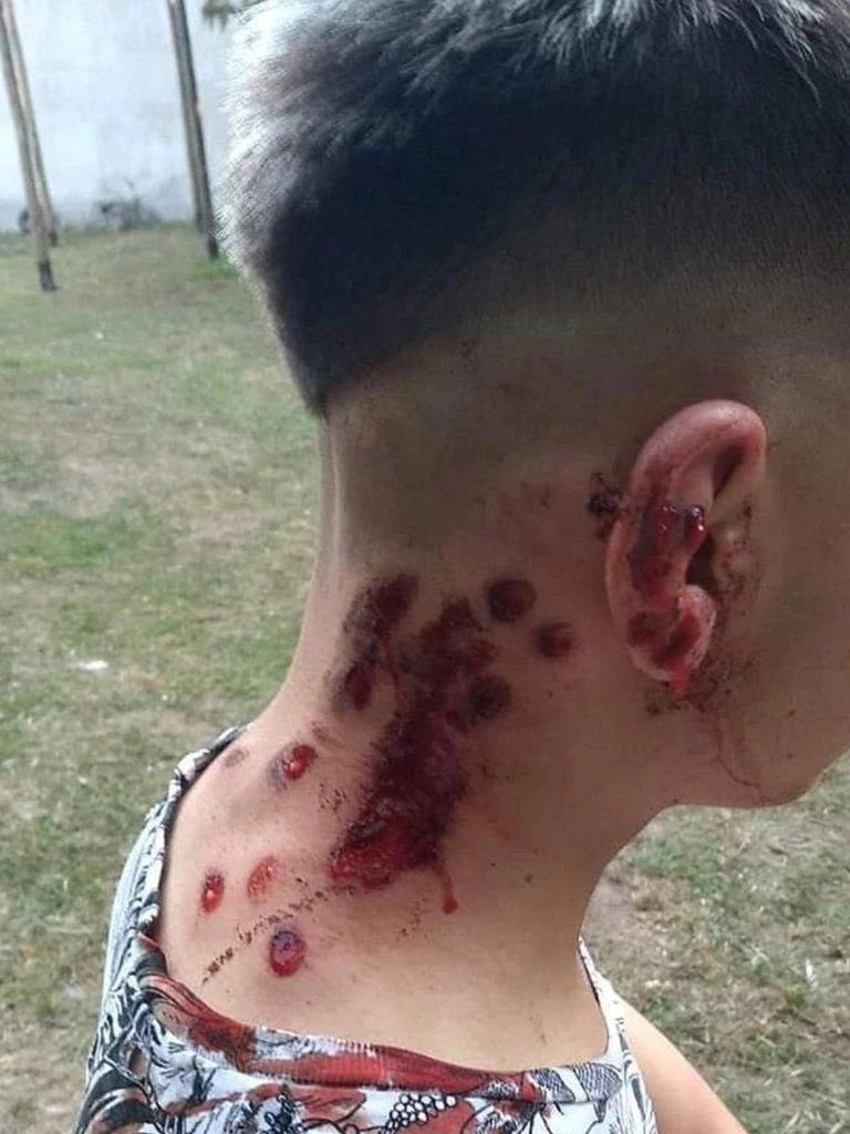 Uno de los once jovenes heridos por la Polica recibio ocho balas de goma en la nuca.