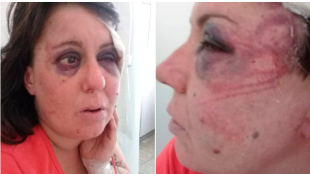   Imágenes de Gisela Knorr en 2019 después de la denuncia al titular de la comisaría de San Clemente. 