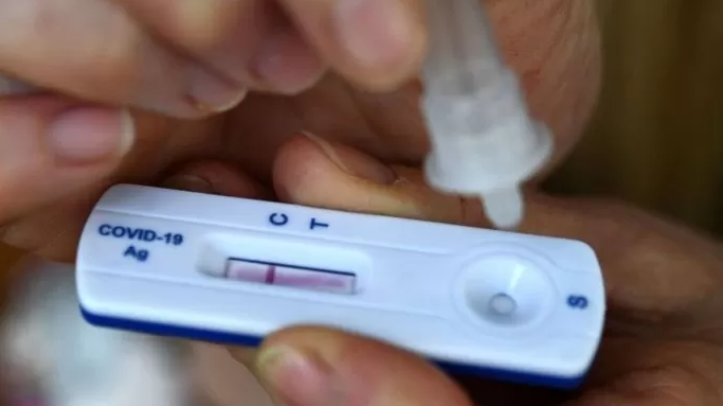 El costo del autotest covid que se pondrá a la venta la semana que viene en las farmacias será de $ 1.560.