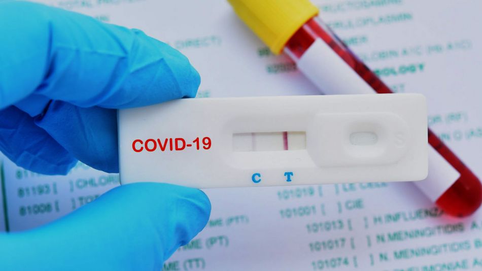 La ANMAT aprobó el uso de cuatro autotest covid de los laboratorios Abbott, Roche, Vyam Group y Wiener.