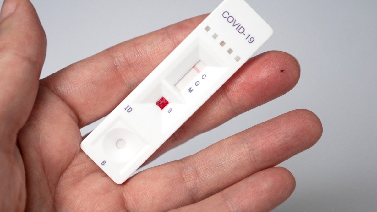 Los autotest covid podrán conseguirse en farmacias