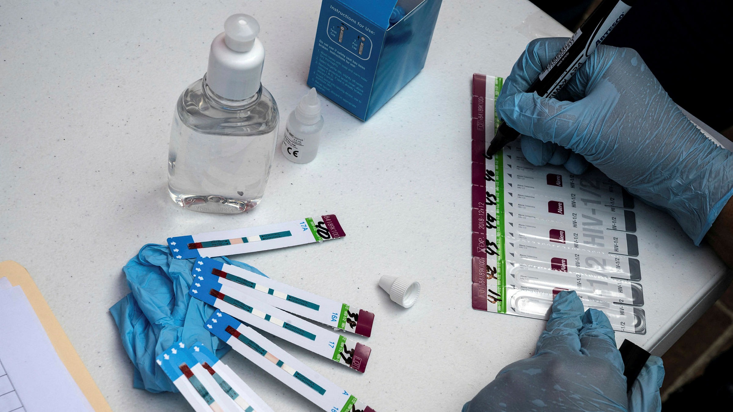 El proyecto de Oxford analizó la secuencia genética del HIV en unas 7500, de las cuales 109 casos presentaron la nueva variante.