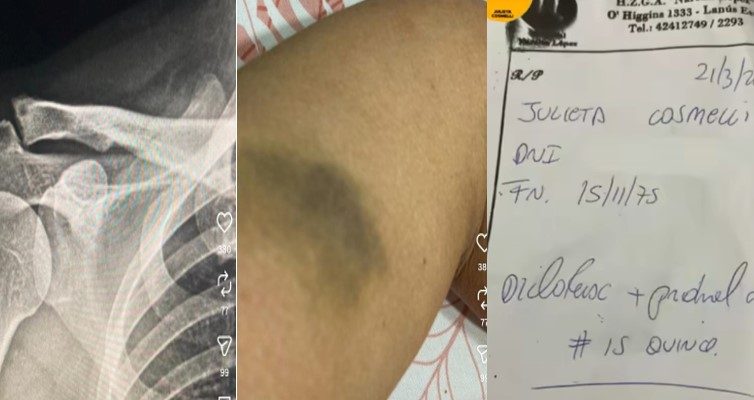 Tras las agresiones sufridas dentro del edificio municipal de Lanús, la denunciante estuvo hospitalizada.